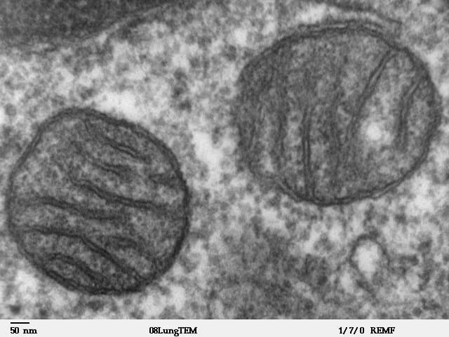 Image de microscope électronique en niveaux de gris montrant deux mitochondries ovales dans un tissu pulmonaire, chacune avec une membrane externe et des membranes internes repliées.